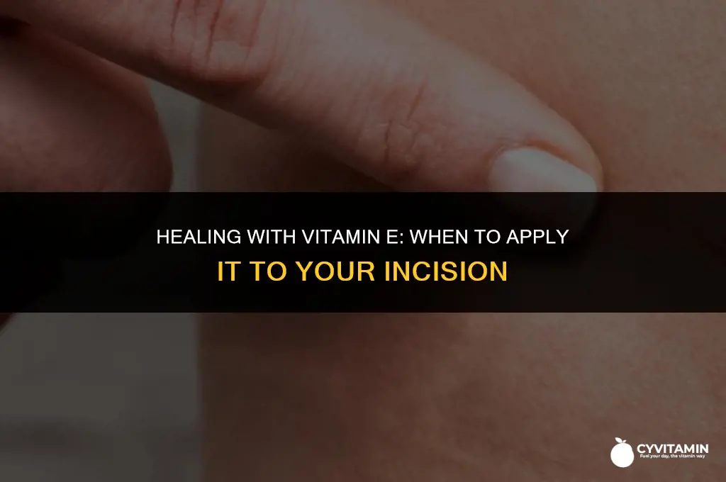 when can i put vitamin e on my incision