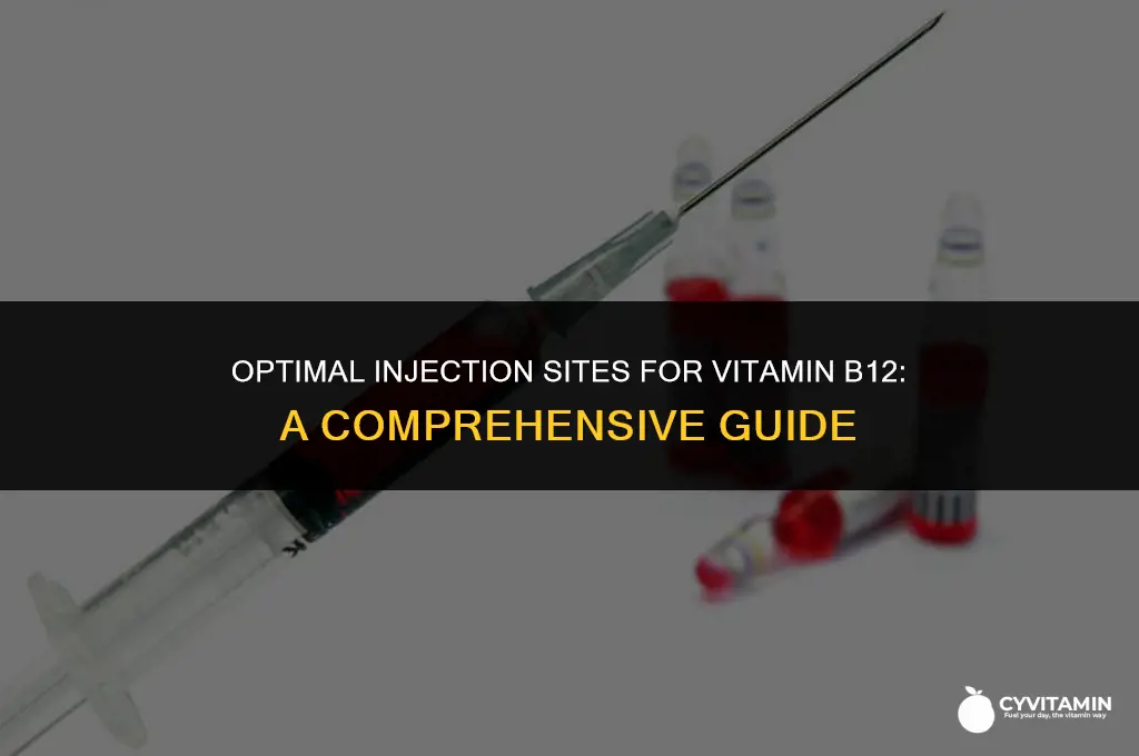 where is the best place to inject vitamin b12