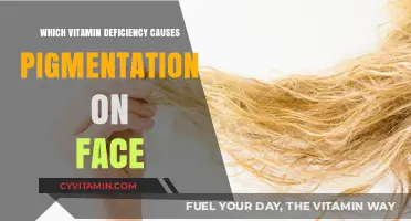Unveiling the Culprit: Vitamin Deficiency Linked to Facial Pigmentation