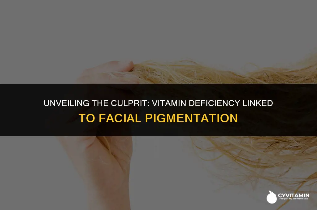 which vitamin deficiency causes pigmentation on face