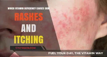 Unveiling the Culprit: Vitamin Deficiencies Behind Skin Rashes and Itching