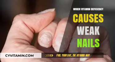 Brittle Nails: Uncovering the Vitamin Deficiency Culprits
