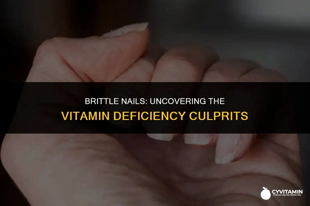 which vitamin deficiency causes weak nails