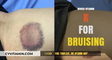 Natural Remedies for Bruising: The Role of Vitamin K
