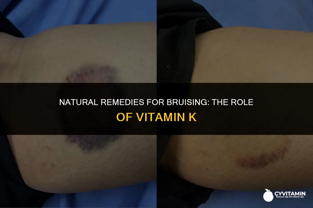 which vitamin k for bruising