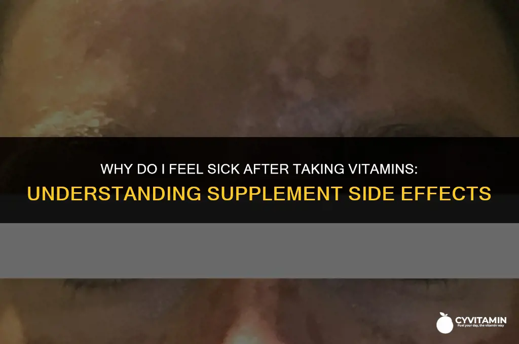 why do i feel sick after taking vitamins