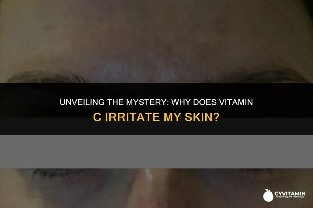 why does vitamin c burn my skin