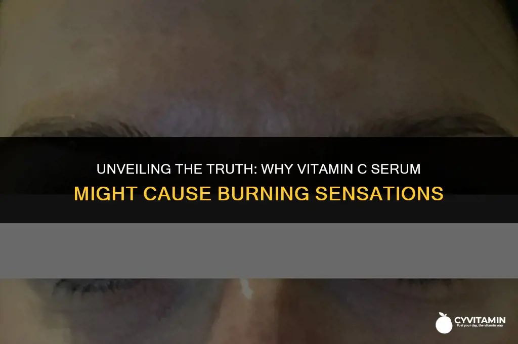 why does vitamin c serum burn
